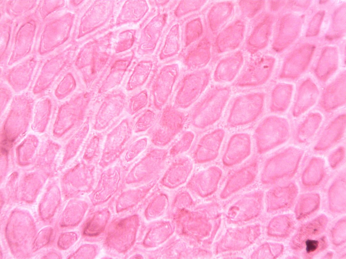 Whole slide H and E stained tissue section with a magnified inset region
